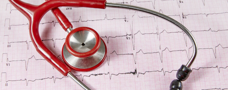 Cardiac electrophysiology - cardiac treatments - cardiac arrhythmia - Pulsed-field ablation atrial fibrillation