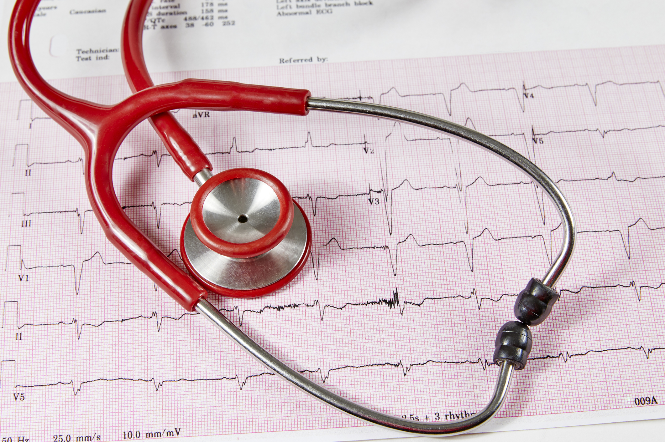 Cardiac electrophysiology - cardiac treatments - cardiac arrhythmia - Pulsed-field ablation atrial fibrillation