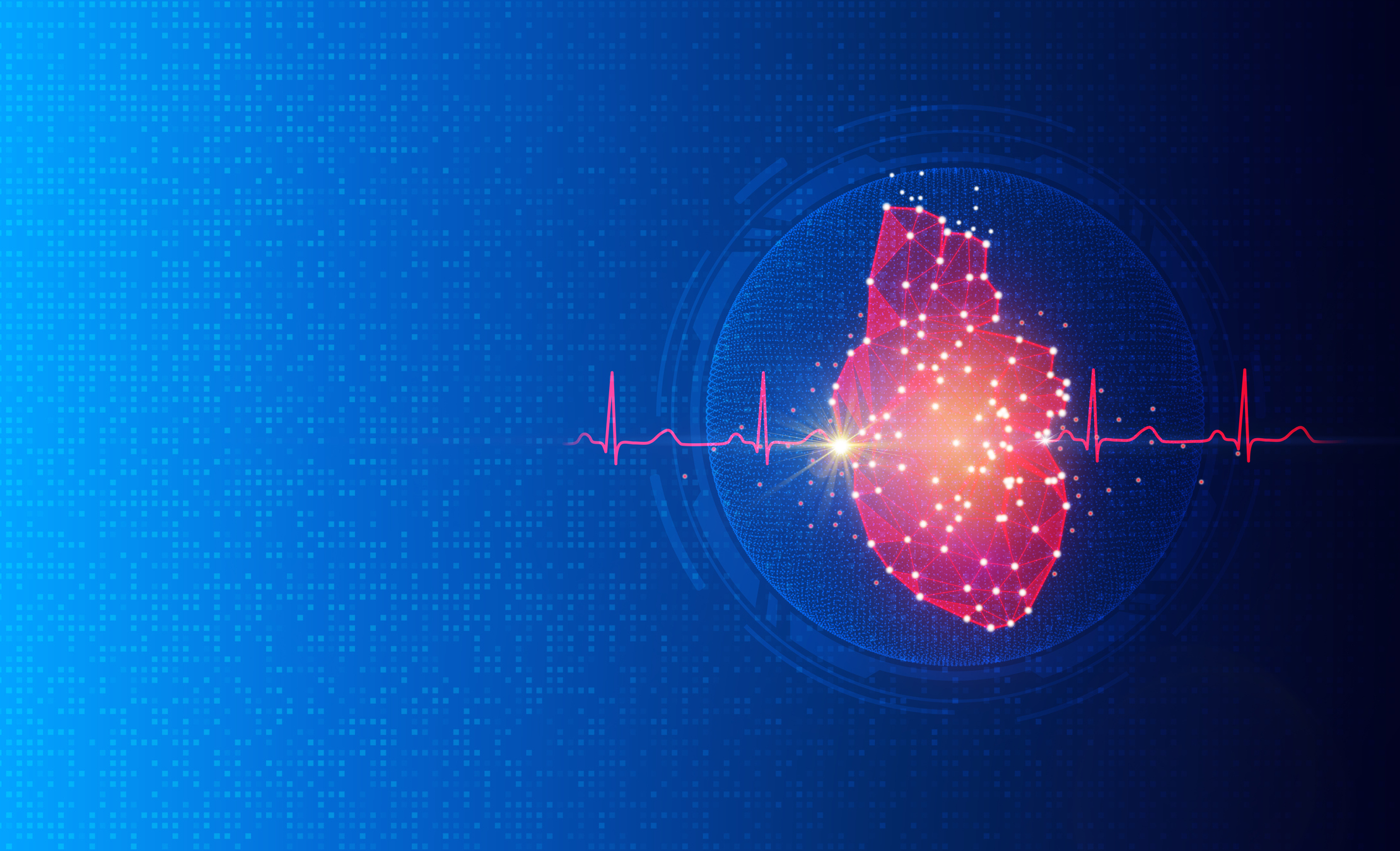 Cardiac electrophysiology - cardiac treatments - cardiac arrhythmia - Pulsed-field ablation atrial fibrillation
