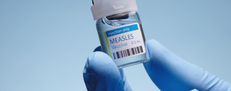 viral disease -