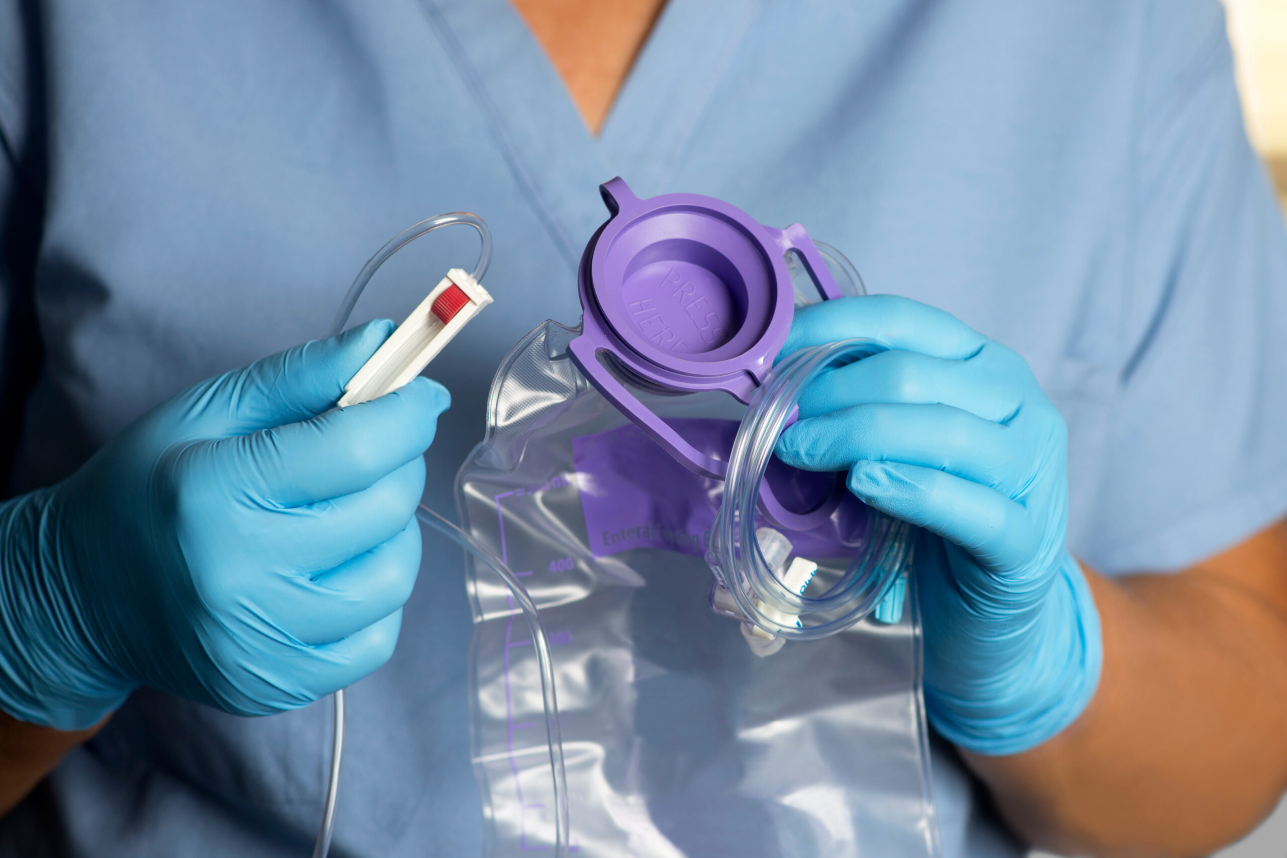 Nurse holds enteral feeding bag and tubing prior to administration.