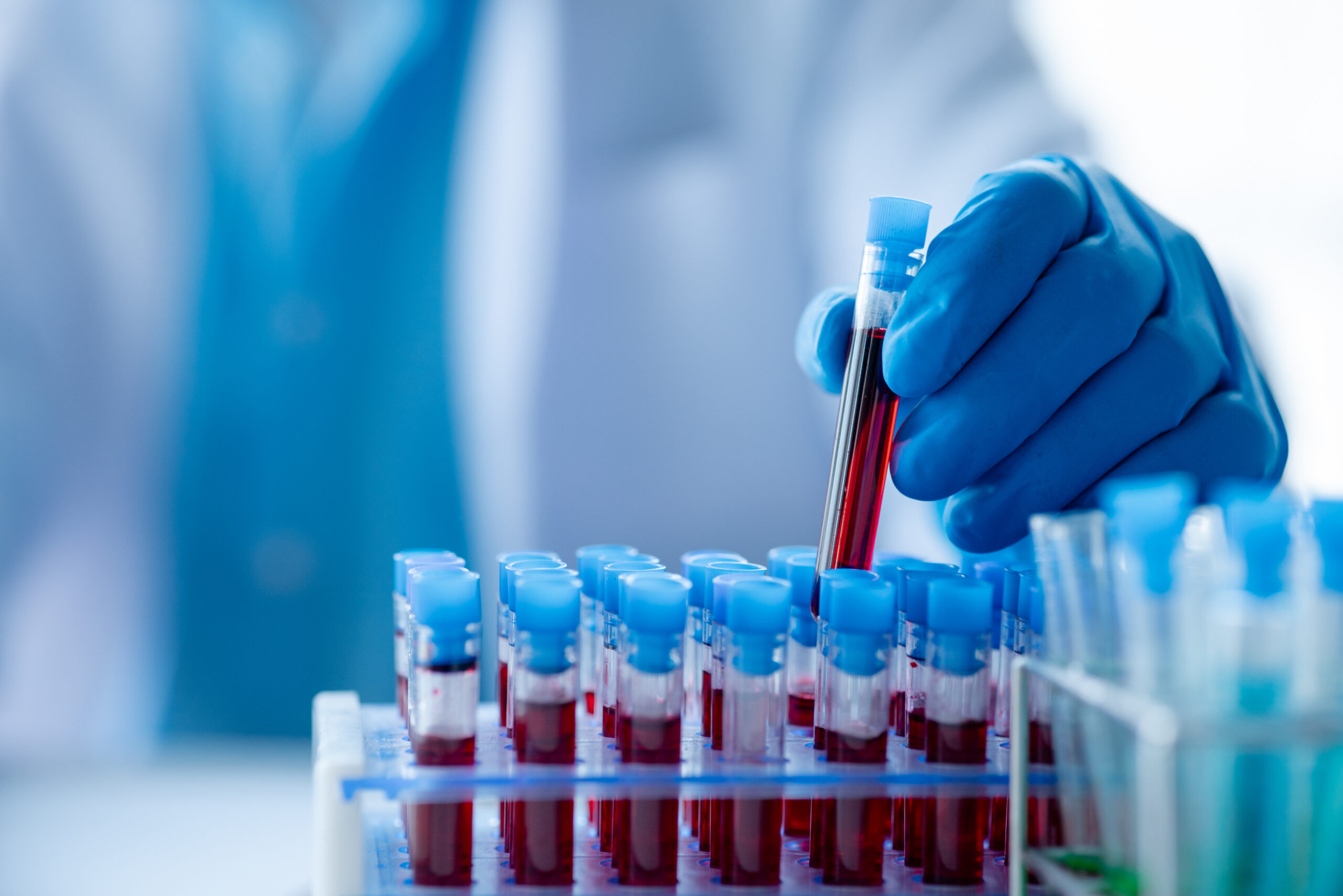 *Nature Medicine* study links Blood Metabolites to early Type 2 Diabetes risk, led by Mass General Brigham and Albert Einstein College of Medicine.