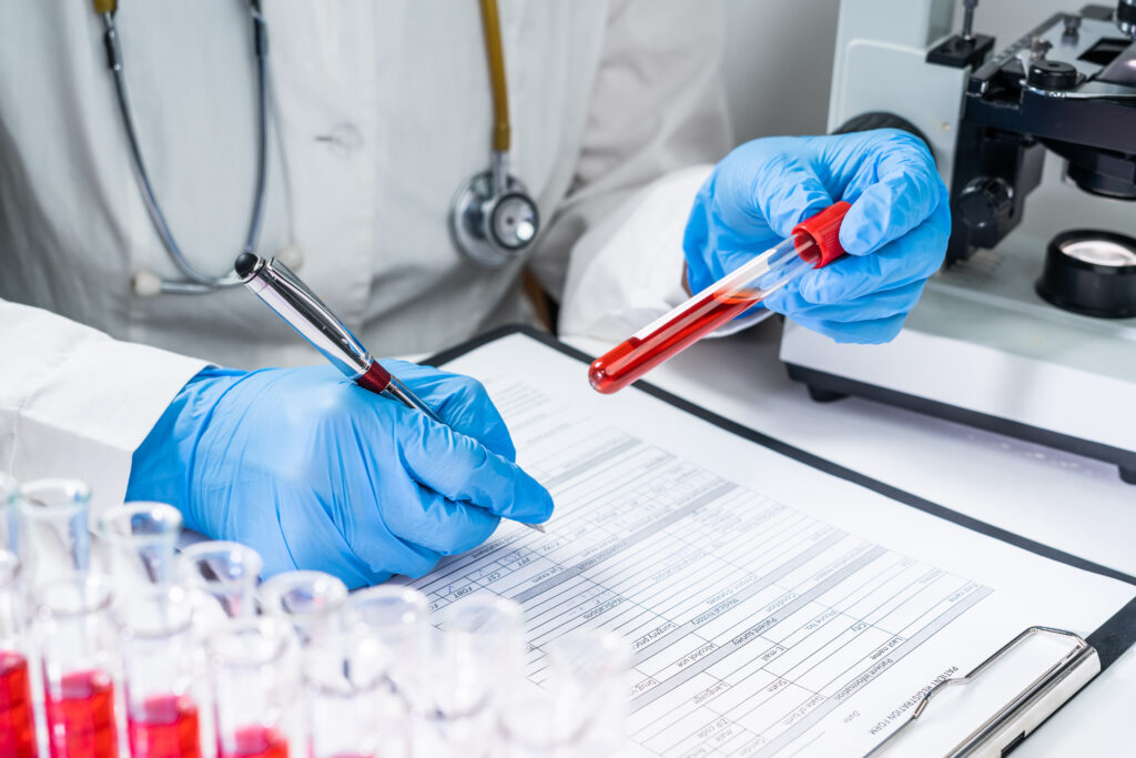 A blood-based biomarker test measuring a protein called p-tau217 significantly improved the accuracy of Alzheimer’s disease diagnosis in routine clinical practice, according to a study published in the Journal of Neurology.