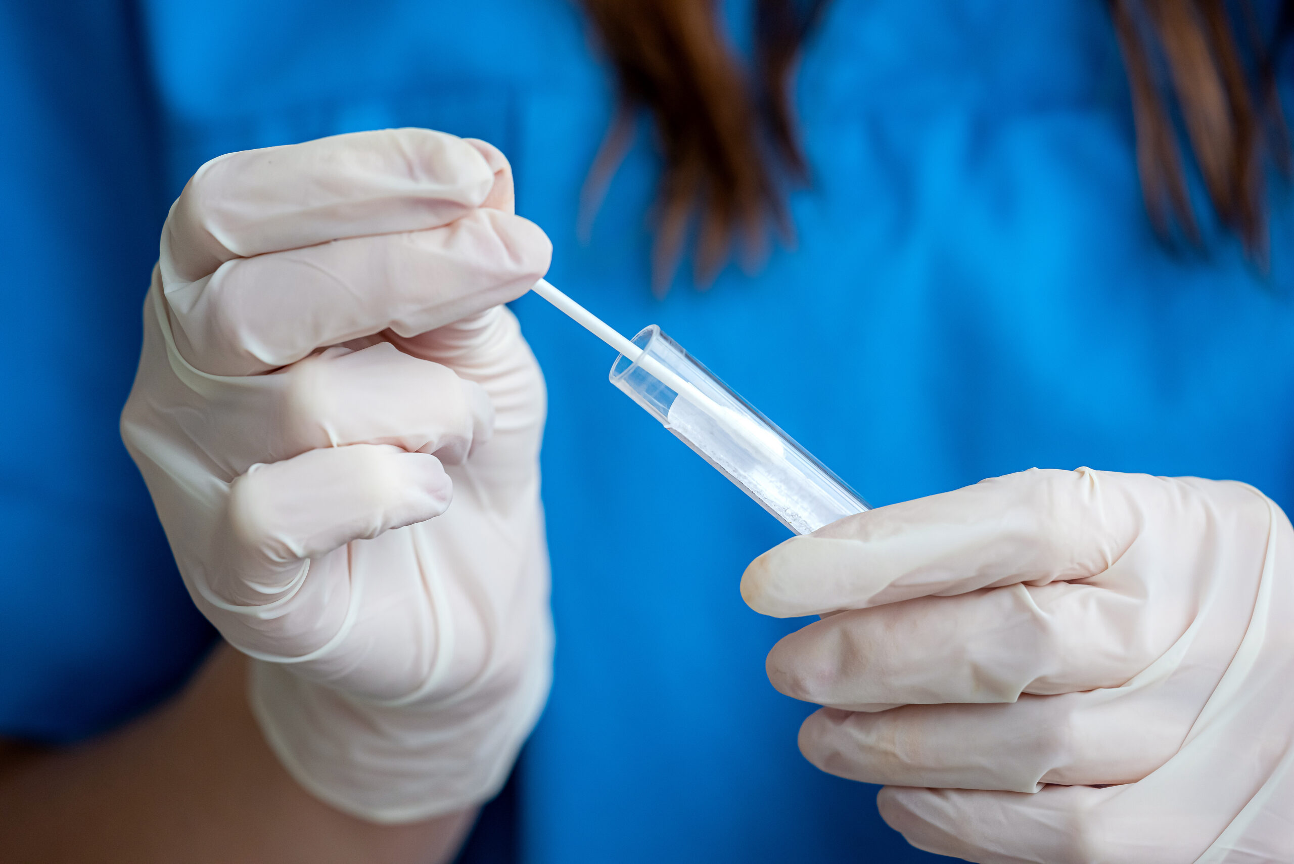 Nature Communications study shows a nasal swab can detect Alzheimer’s biological markers for early Alzheimer’s detection.