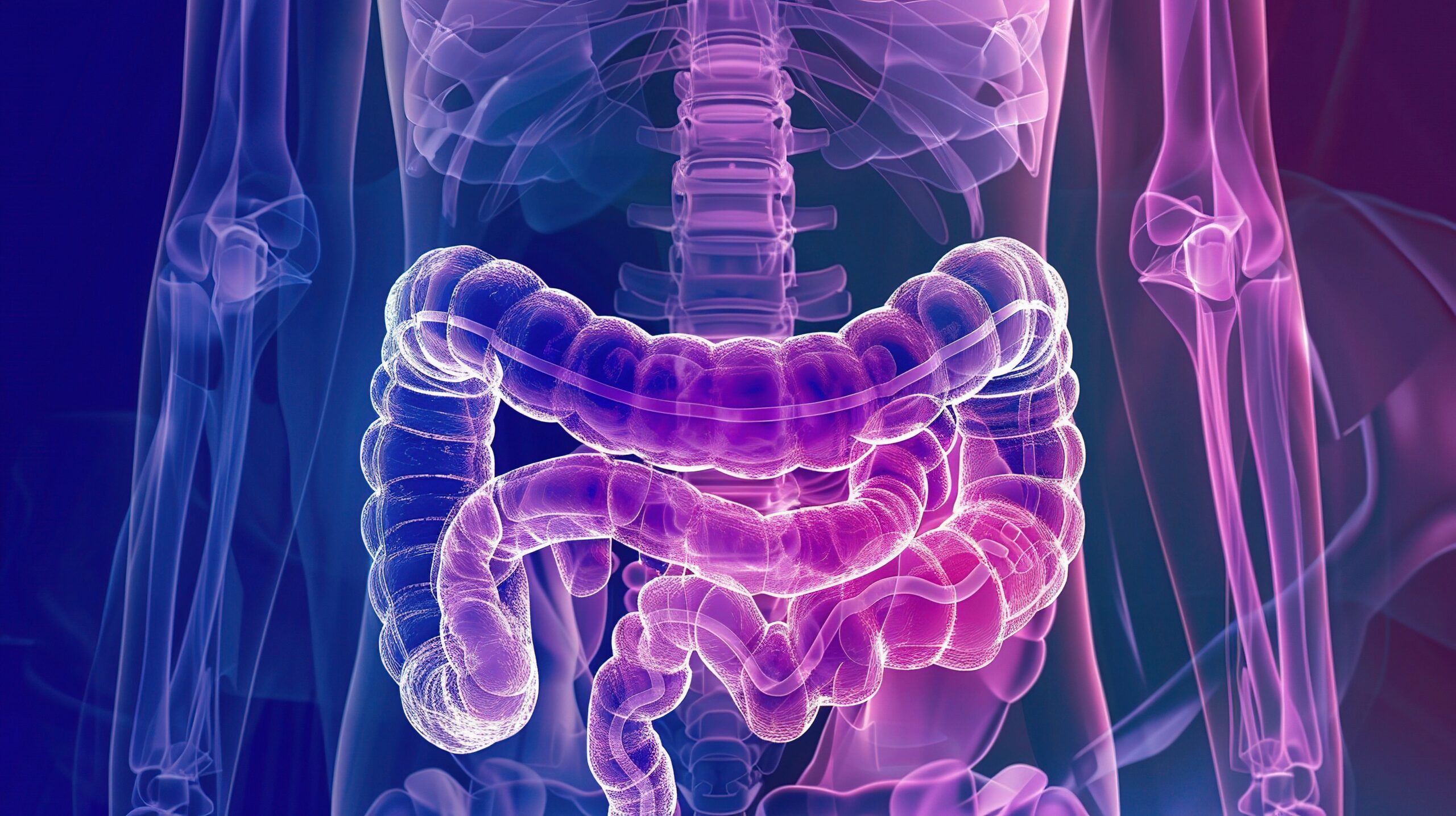 Bowel cancer immunotherapy trial shows no relapses, with NEOPRISM-CRC results at the American Association for Cancer Research.