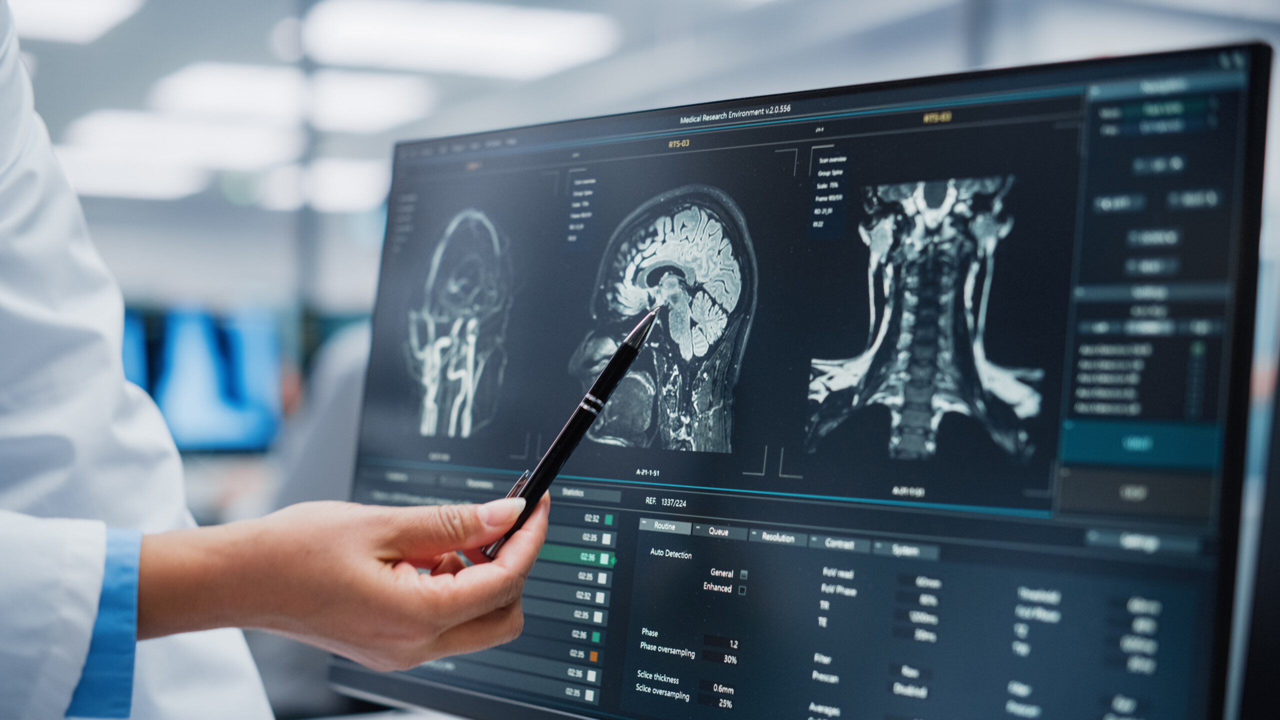 Discover how Brain Degeneration links Alzheimer's Disease and Neurodegenerative Conditions through a key cellular pathway in the brain's immune cells.