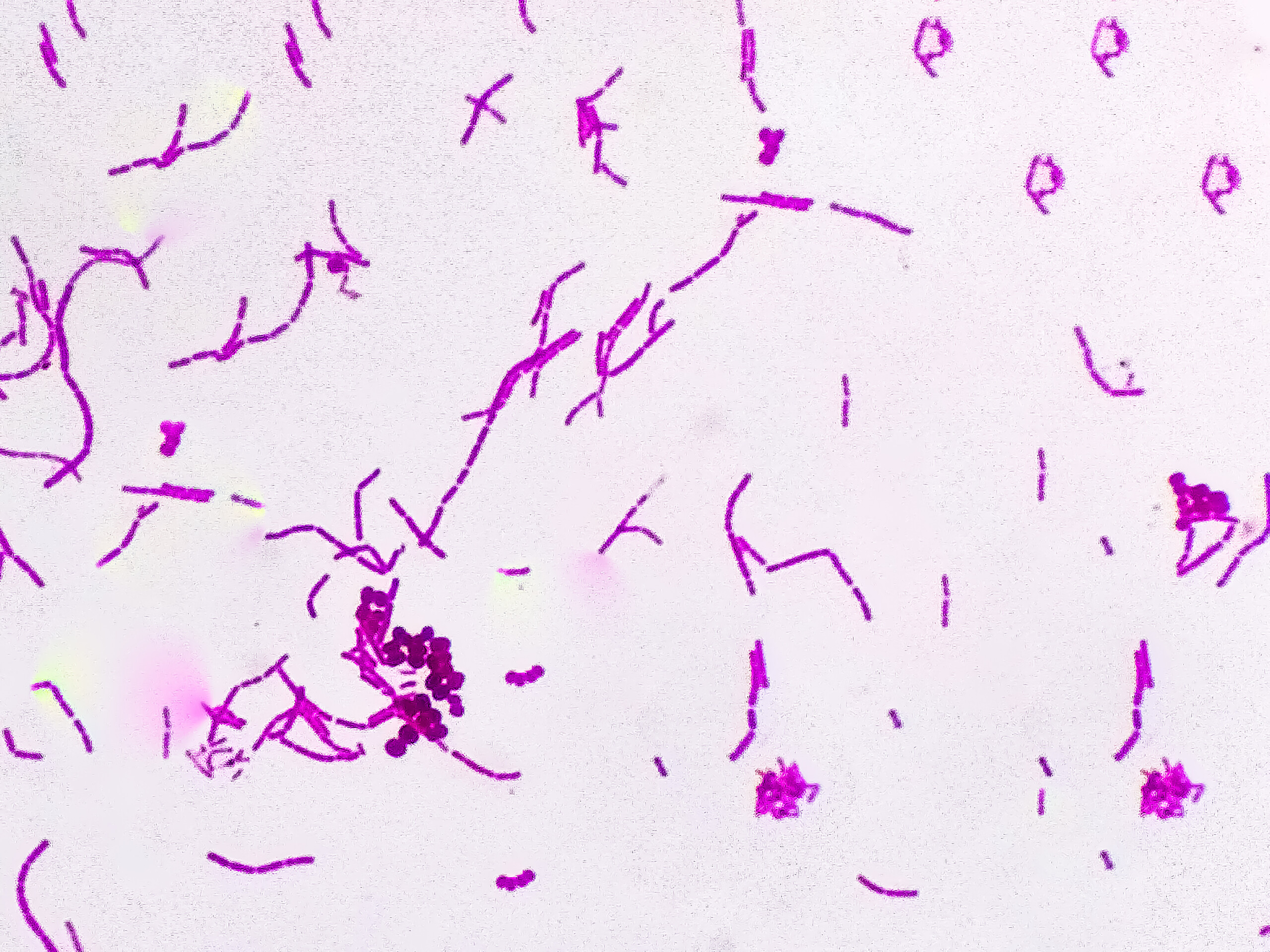 Artificial intelligence identifies a compound targeting streptococcus pneumoniae, showing activity against drug-resistant strains in a 7,000-drug screen.